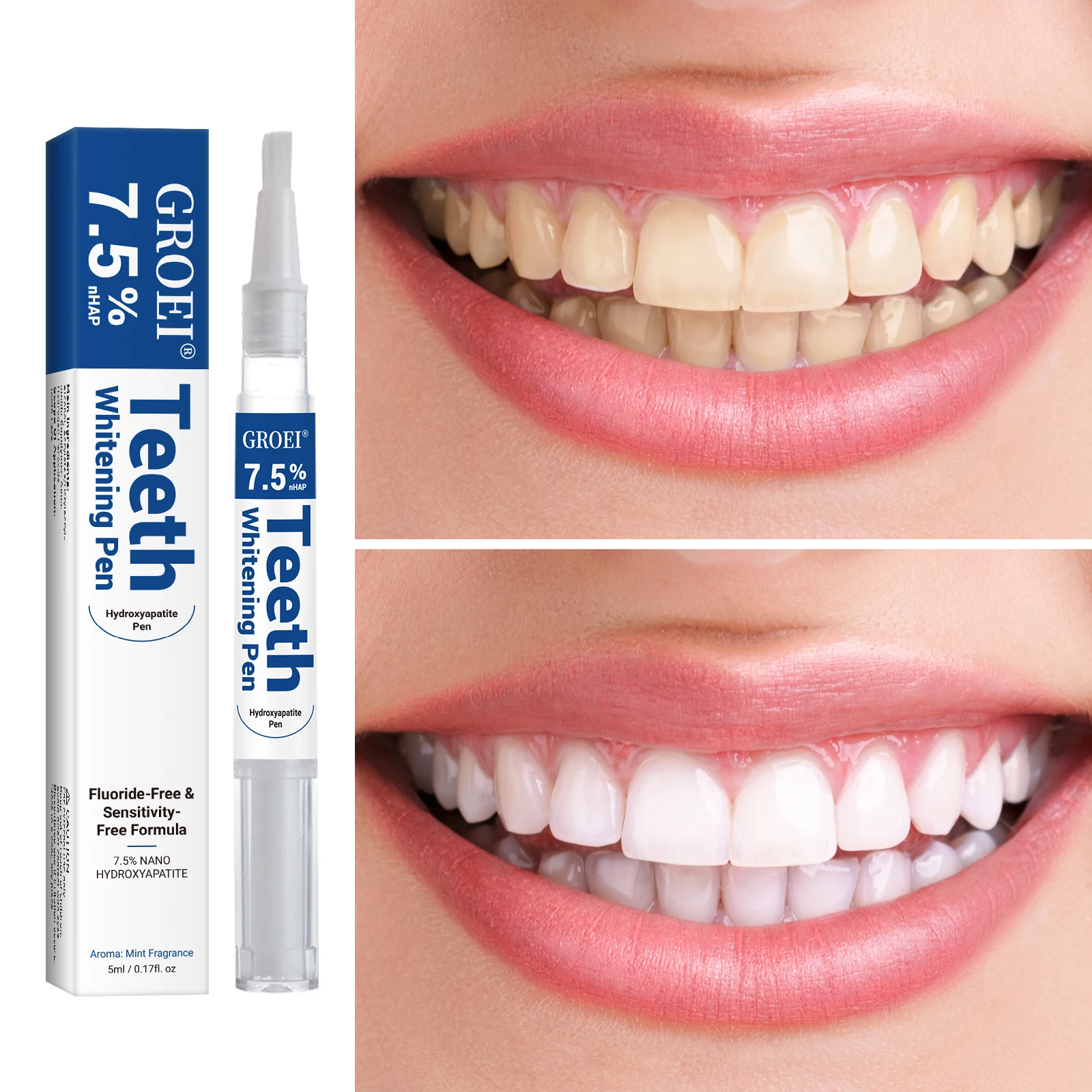 Penna per sbiancamento dei den - Teeth Whitening Price recensione e prezzo