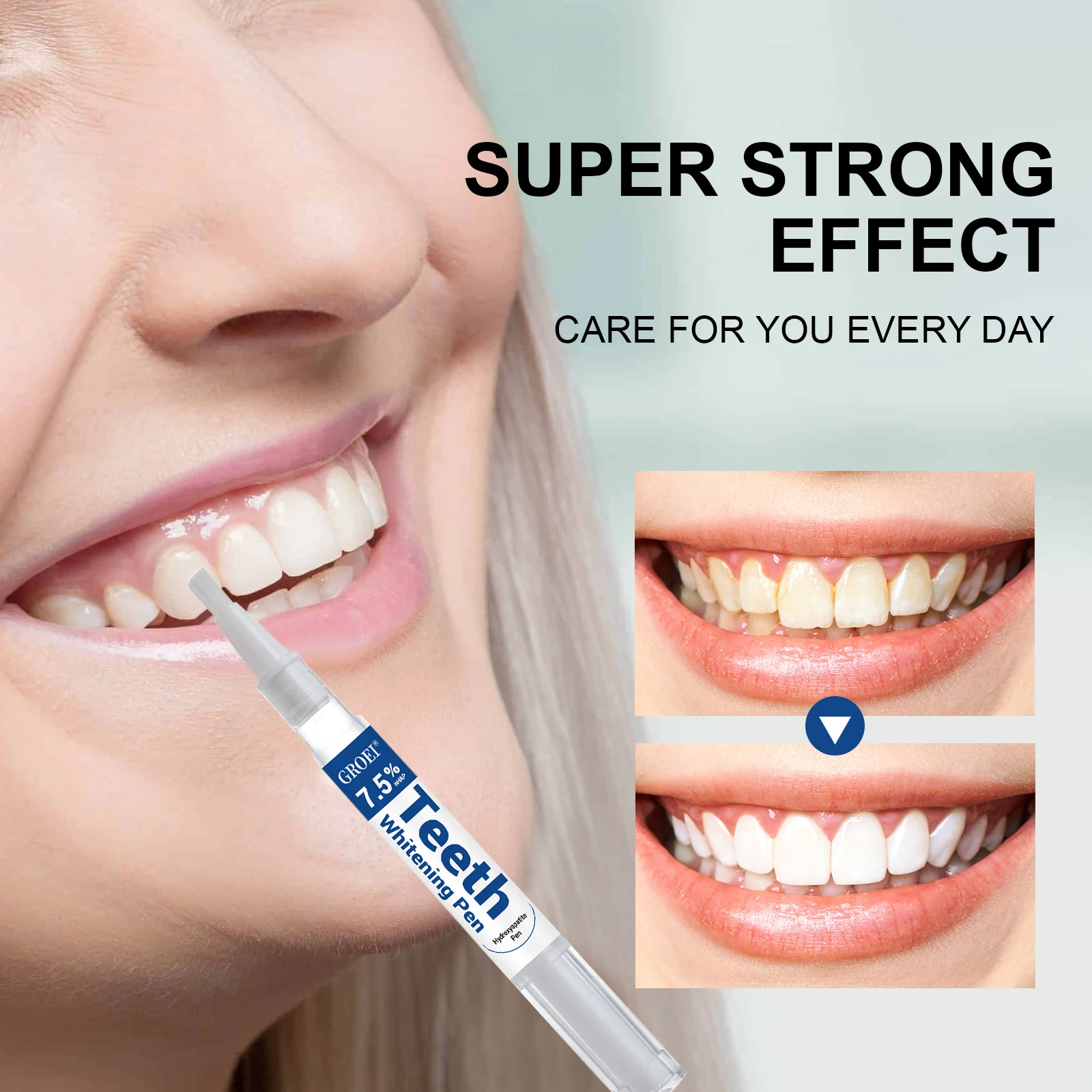 Penna per sbiancamento dei den - Teeth Whitening Price recensione e prezzo