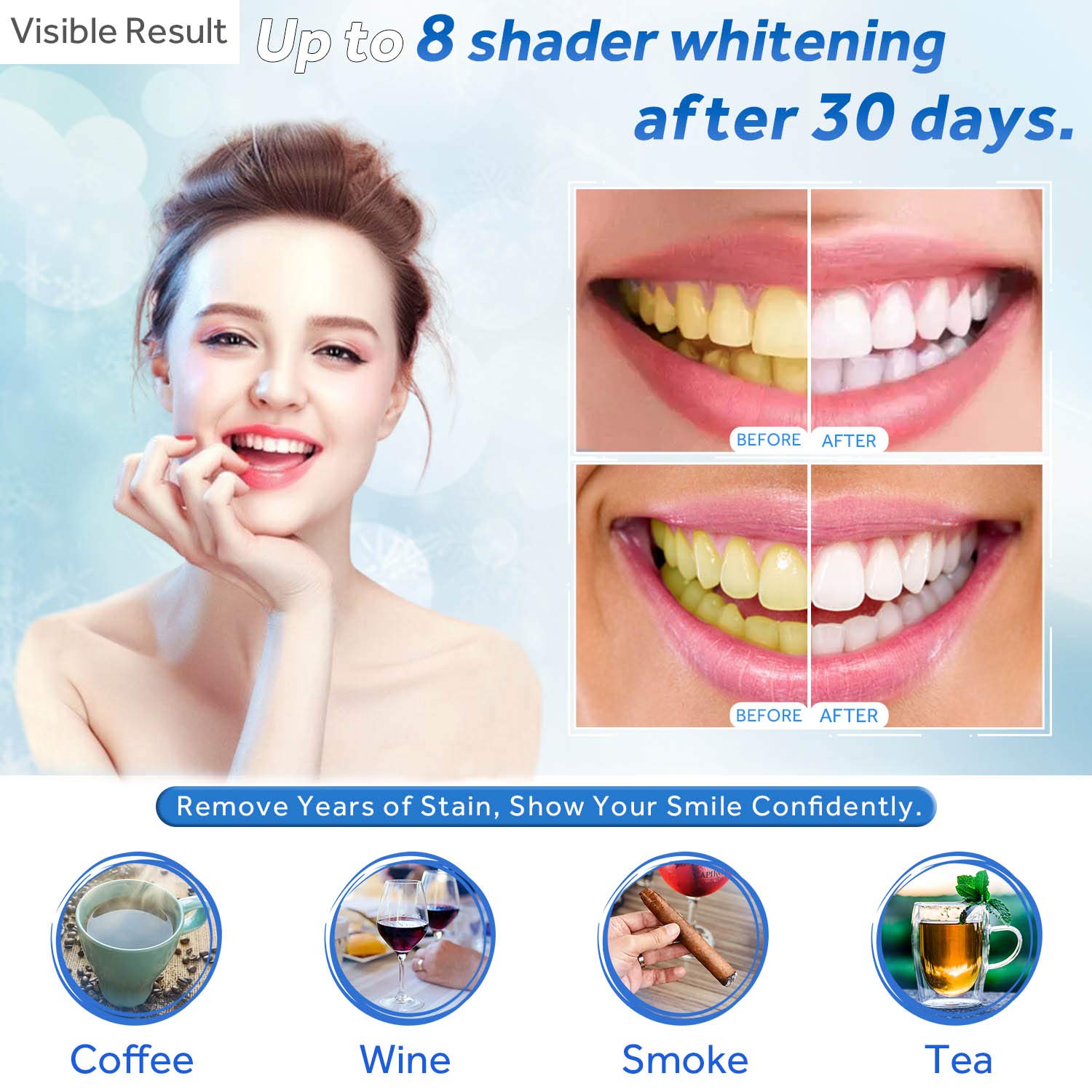 Gel sbiancante per denti Ricar - Teeth Whitening Price recensione e prezzo
