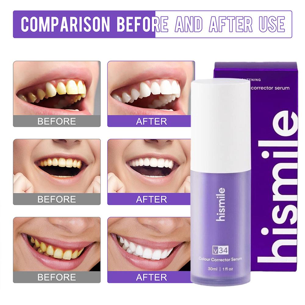    Siero sbiancante per denti - Teeth Whitening Crest recensione e prezzo