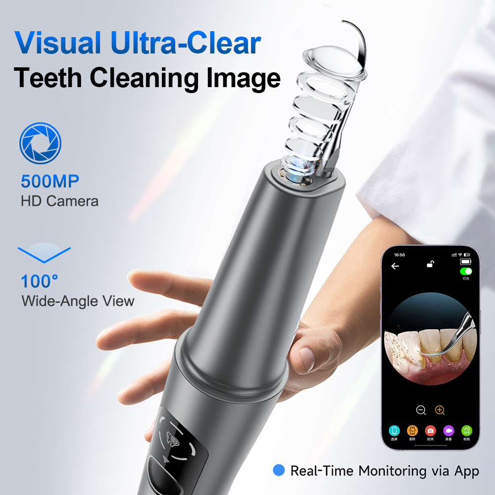 Nuovo Ablatore Dentale a Ultra - Teeth Whitening Kit Professional recensione e prezzo